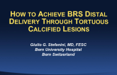 How to Achieve BRS Distal Delivery Through Tortuous Calcified Lesions