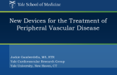 New Devices for the Treatment of Peripheral Arterial Disease