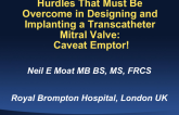 Hurdles That Must Be Overcome in Designing and Implanting a Transcatheter Mitral Valve: Caveat Emptor! Insights from a Cardiac Surgeon