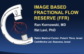 The CathWorks Technology for Image-Based FFR During Coronary Catheterization