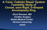 ValCare Medical Transcatheter Repair System: Feasibility Study of Rigid D-Shaped Annuloplasty Ring