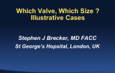 Which Valve, Which Size? Three Illustrative Cases