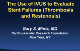 Use of IVUS to Evaluate Stent Failures (Thrombosis and Restenosis)