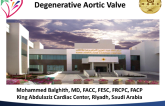 Case #1: A Degenerative Aortic Valve