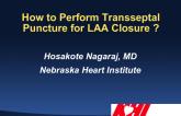 How to Perform Transseptal Puncture for LAA Closure
