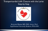 Transpericardial LAA Closure with the Lariat Step-by-Step
