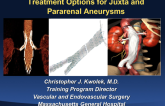 Treatment Options for Juxtarenal and Pararenal Aneurysms