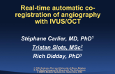 Real-Time Automatic Coregistration of Angiography with IVUS and OCT