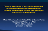 TCT 63: Objective Assessment of Intracardiac Conduction to Guide Permanent Pacemaker Implantation Following Alcohol Septal Ablation for Hypertrophic Obstructive Cardiomyopathy
