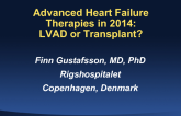 Advanced Heart Failure Therapies in 2014: LVAD or Transplant?