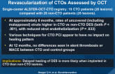 Delayed Coverage of DES After Interventional Revascularization of CTOs Assessed by OCT