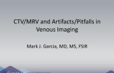 CTV,MRV and Artifacts, Pitfalls in Venous Imaging