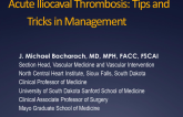 Acute Iliocaval Thrombosis – Tips and Tricks in Management