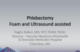 Phlebectomy Foam and Ultrasound Assisted