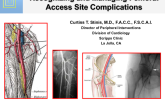 Recognizing and Managing Femoral Access Site Complications