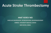 Acute Stroke Thrombectomy