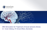 SPG Stimulation for Treatment of Acute Ischemic Stroke