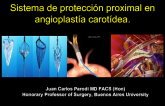 Sistema de protección proximal en angioplastía carotídea_