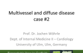 Multivessel and diffuse disease case #2