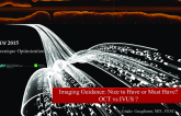 Imaging Guidance: Nice to Have or Must Have? OCT vs IVUS ?