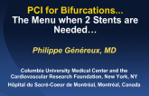 PCI for Bifurcations:The Menu when 2 Stents are Needed