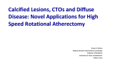 Calcified Lesions, CTOs and Diffuse Disease: Novel Applications for High Speed Rotational Atherectomy