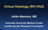 Virtual Histology (RF) IVUS