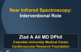 Near Infrared Spectroscopy: Interventional Role
