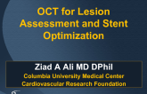 OCT for Lesion Assessment and Stent Optimization