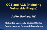 OCT and ACS (Including Vulnerable Plaque)