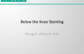 Below the Knee Stenting