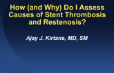How (and Why) Do I Assess Causes of Stent Thrombosis and Restenosis?