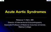 Acute Aortic Syndromes