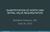 Quantification of Aortic and Mitral Valve Regurgitation