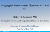 Imaging for Transcatheter Closure of ASD and VSD