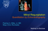 Mitral Regurgitation Quantitation by Echocardiography