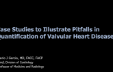 Case Studies to Illustrate Pitfalls in Quantification of Valvular Heart Disease