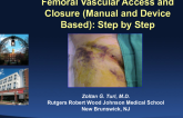 Femoral Vascular Access and Closure (Manual and Device Based): A Step-by-Step Approach