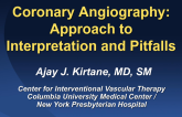 Coronary Angiography: Indications, Limitations, and Artifacts