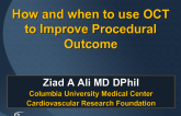How and When to Use OCT in the Cath Lab
