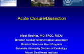 Complication Case 2: Acute Closure/Dissection