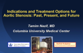 Indications and Treatment Options for Aortic Stenosis: Past, Present, and Future