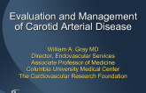Evaluation and Management of Carotid Arterial Disease