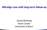 Mitralign Case With Long-term Follow-up