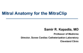 Primer on Mitral Anatomy for the MitraClip: Are There Limitations to Treatment?