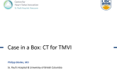 Case in a Box: CT and Echo for Transcatheter MV Replacement