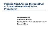 Imaging Needs Across the Spectrum of Transcatheter Mitral Valve Procedures