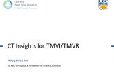 CT Insights for Transcatheter Mitral Valve Repair and Replacement