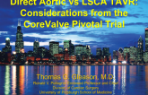 Direct Aortic vs Subclavian-Axillary TAVR: Lessons From the CoreValve Pivotal Trial
