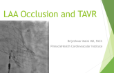 Case Presentation: LAA Occlusion and TAVR